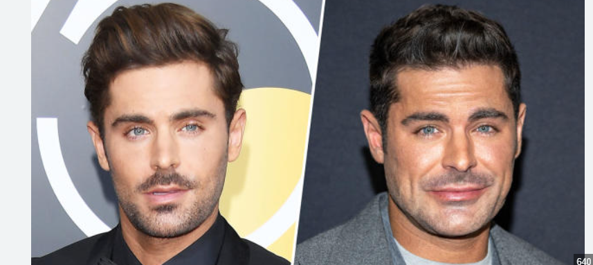 Zac Efron Jaw Surgery Rumours: Truth Behind the Speculation